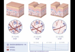 都在問(wèn)的乙酰殼糖胺（NAG）功效怎么樣？功效成分的護(hù)膚品應(yīng)該怎么選？
